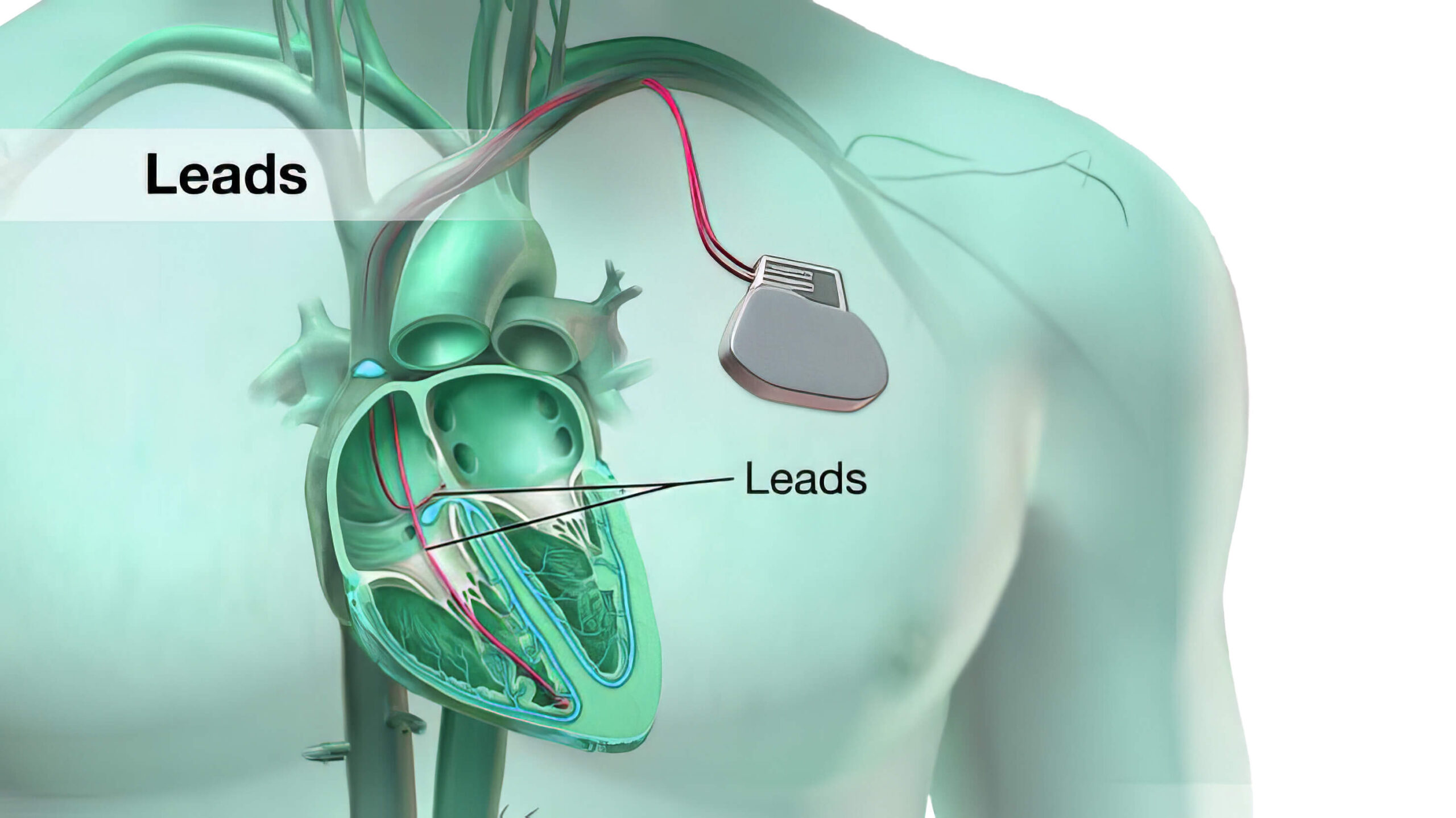 PEMF Therapy — eMedica